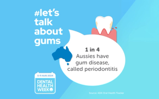 Let’s Talk About Gums
